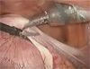 ���١, �Ѵ���١, ���ͧ͡���١, �պص��ҡ (BLASTOCYST) ��д����آ�Ҿʵ�շء�����ʶҺѹ����࿤����� �ç��Һ�Ż����Ƿ